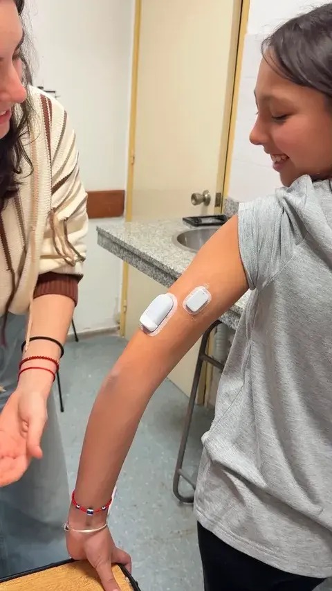Guille with a 300U tubeless insulin pump on her arm.